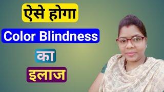 Color blindness Treatment In Hindi | Color Blindness | color blindness kaise thik hota hai |