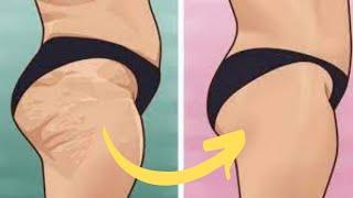 HOW to get rid of CELLULITE on the bottom, on the thighs, on the legs? At home