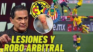 FMF CONFIRMA CASTIGO CLUB AMERICA FUE VÍCTIMA DEL ARBITRAJE, EL VAR DESAPARECIÓ CLUB AMÉRICA HOY