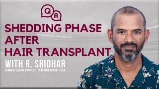 Shedding Phase After Hair Transplant: Coach R. Sridhar's Take on Hair Transplant Shedding