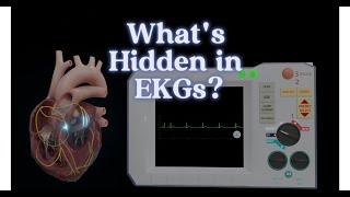 EKG Waves Made Easy (Animated) | Simple EKG Interpretation Guide