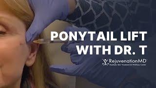 What is a Ponytail Lift with Filler?