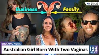 Australian Girl Born With Two Vaginas | ISH News