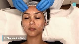 Microdermabrasion Treatment at The Private Clinic