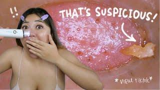 VIRAL *TIKTOK* BLACKHEAD & CAMERA SUCTION! (you need this!!!)