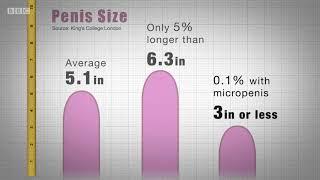 Penis sizes: average, more than average; micro