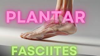 Plantar Fasciitis | Heel Pain | Cured