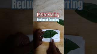 Get Faster Healing With Less Scarring. #health #healing #naturalhealing