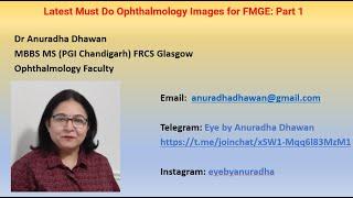 Latest Must Do Ophthalmology Images for FMGE: Part 1