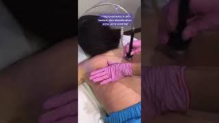 Diamond Glow Back Facial | Suddenly Slimmer Med Spa Phoenix