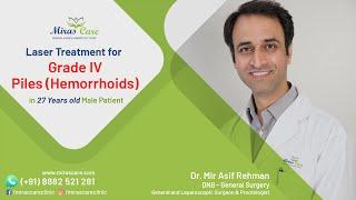 Grade-IV Hemorrhoids/Piles Laser Treatment - Dr. Mir Asif, Mirascare Multispecialty Clinic, Gurgaon