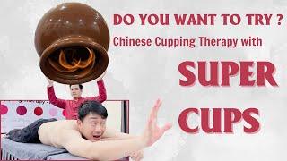 This is the largest cupping cup in the world.