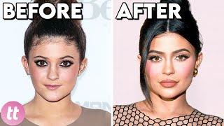 Celebrities Before And After Plastic Surgery