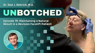 UNBOTCHED Ep.19: Maintaining a Natural Result in a Revision Facelift Patient with Dr. Rohrich