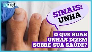 O que suas UNHAS  podeM dizer sobre sua SAÚDE #unhas #dermatologia