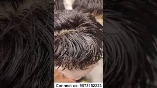 Buy Miraj hair patch at affordable prices #shorts #hairpatch #hairwig