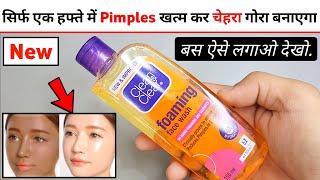 Clean And Clear Face Wash Review 2024 | clean clear face wash | clean clear face wash kaise use kare