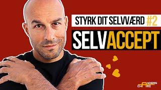 STYRK DIT SELVVÆRD ep. 2 – Start ALTID med SELVACCEPT hvis du skal overvinde dårligt selvværd