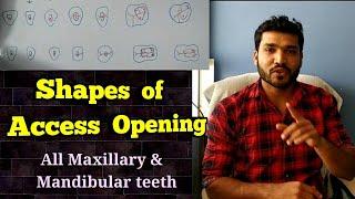 Shapes of access opening of Maxillary and Mandibular teeth..