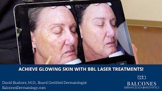 Achieve Glowing Skin with BBL Laser Treatments! | David Bushore, MD, FAAD | Austin, TX