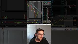 FASTEST Way To Set A Stop-Loss ThinkorSwim #thinkorswim #daytrading #shorts #teambull