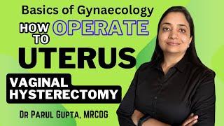 Vaginal Hysterectomy | Steps & Techniques | Viva Exam Question |