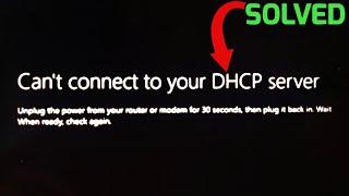 How To FIX Xbox Series S Can’t Connect to DHCP Server | Full Tutorial