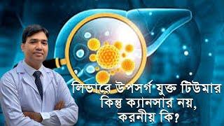 লিভারে উপসর্গ যুক্ত টিউমার কিন্তু ক্যানসার নয়, করনীয় কি?    #liver tumor #liver cancer #liver