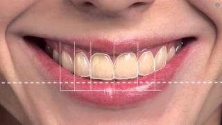 Digital Smile Design - Animation