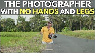 The Photographer With No Hands And Legs