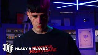 Vercetti CG  - Hlasy v hlavě 2 ft. ShakaCG (OFF.VIDEO) prod. Spack Jarrow