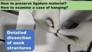 How to examine a case of hanging?
