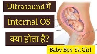 What is Internal OS? प्रेगनेंसी में internal os is closed का क्या मतलब है | Baby Boy Scan