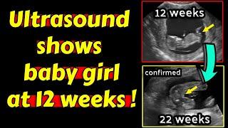 Ultrasound shows baby girl at 12 weeks pregnancy !