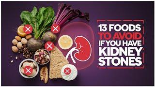 13 Foods to Avoid if You Have Kidney Stones