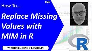 How To... Replace Missing Values with the Median Imputation Method in R #76
