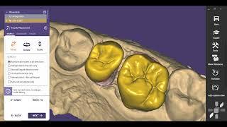 Two Anatomic Crowns Premolar and Molar with Exocad program Very Easy