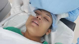 Girl Falls into Deep Sleep Anesthesia for Jaw Surgery