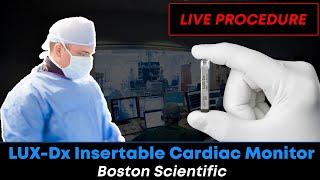 Implanting the LUX-Dx Insertable Cardiac Monitor (ICM), Boston Scientific