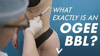 The OGEE BBL - My Brazilian Butt Lift Secret