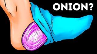 Put an Onion in Your Sock Before Bed, Wake Up to This!