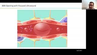 Focused Ultrasound & the Future of Neurosurgery