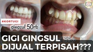 Gigi Gingsul Dijual Terpisah | KorTuGi