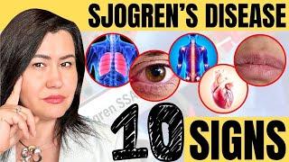 10 Signs of Sjogren's Syndrome - a very complex autoimmune disease