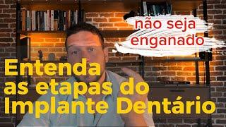 Não seja enganado, entenda as etapas do implante dentário.