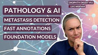 PATHOLOGY & AI: METASTASIS DETECTION, FAST ANNOTATIONS & FOUNDATION MODELS