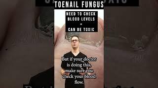 What Kills Toenail Fungus Instantly? [Toenail Fungus Medications]