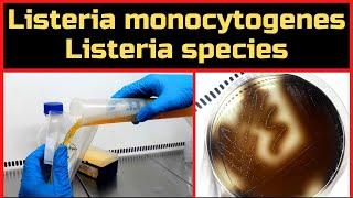 Detection of Listeria monocytogenes & Listeria species_Complete Procedure (ISO 11290-1 & BAM, Ch-10)