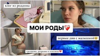 МОИ РОДЫ️‍🩹 Я РОДИЛА! ИСТОРИЯ МОИХ РОДОВ И ПЕРВЫЕ ДНИ С МАЛЫШКОЙ ПЦ КОНЧАЛОВСКОГО