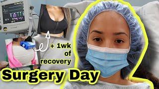 Breast Augmentation Surgery Day Vlog | 450cc Saline Implants
